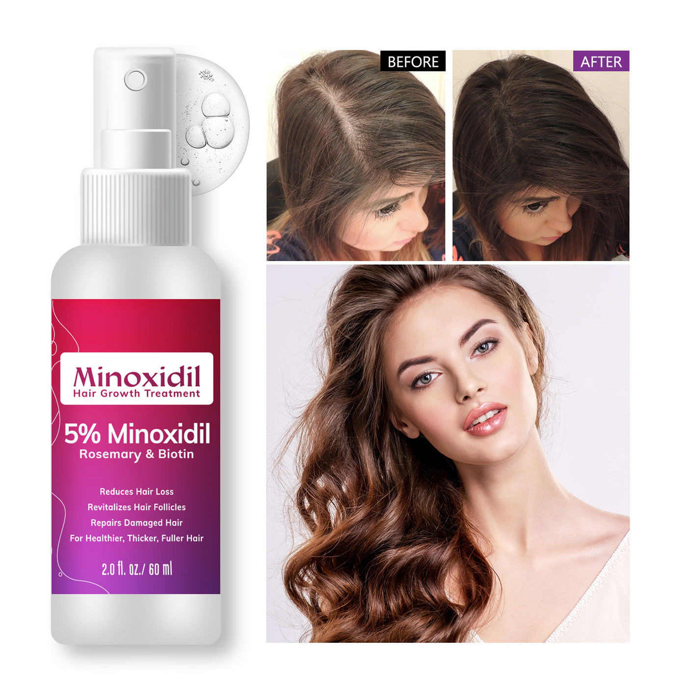 Anti-hair Loss Nourishing Hair Root Massage Hair Care Spray