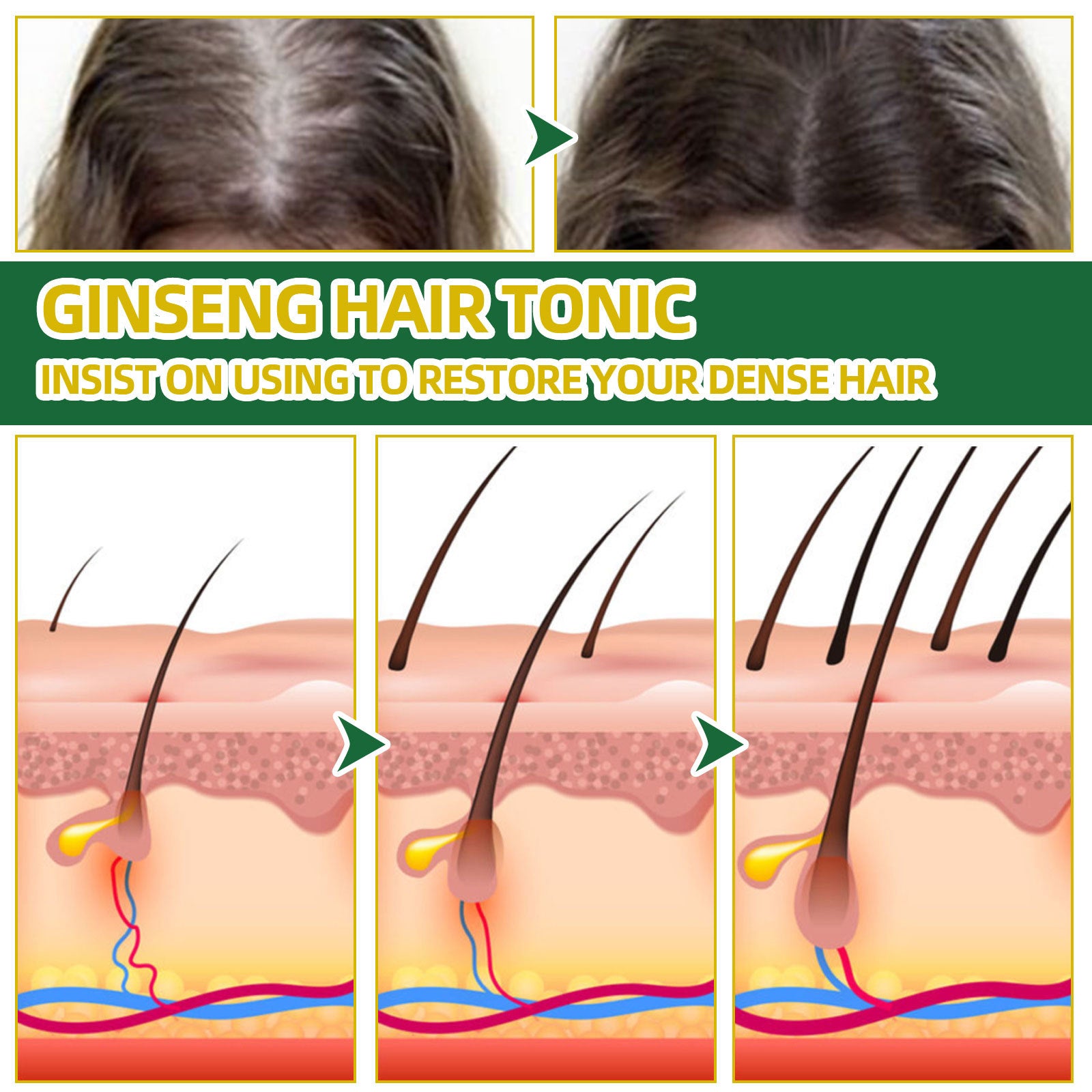 Ginseng Hair Growth Liquid Spray To Prevent Hair Loss