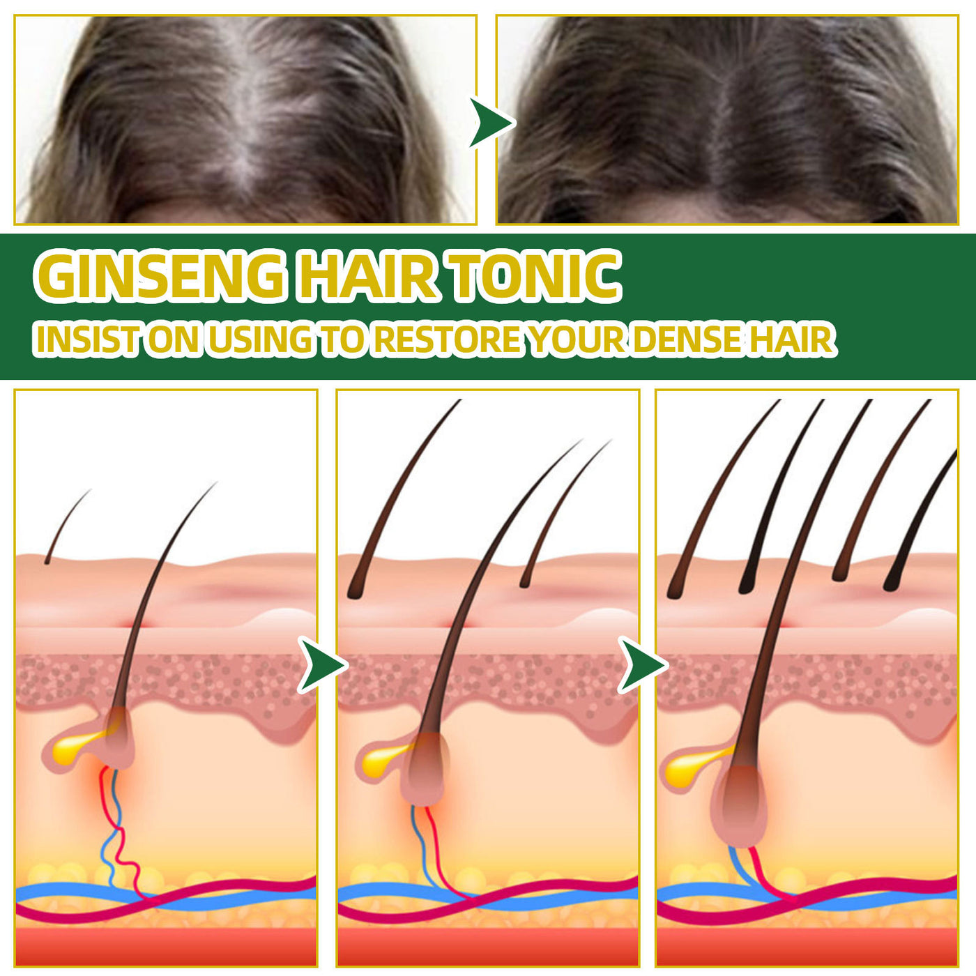 Ginseng Hair Growth Liquid Spray To Prevent Hair Loss